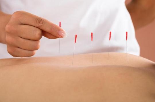 Découvrez acupuncture thérapeutique aux multiples bienfaits