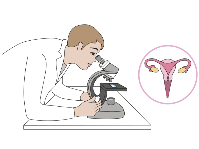 Frottis : ce qu’il ne faut pas oublier !